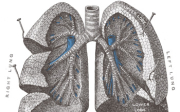 Idiopatická plicní fibróza