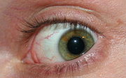 Oční klinika DuoVize