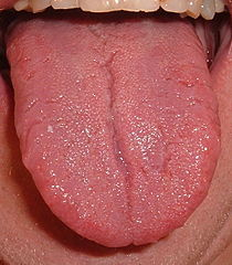 Žlutý povlak na jazyku